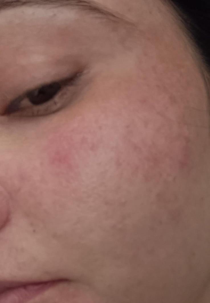 Extra Glow Skin Brightening Cream – Instant Glow in 7 days